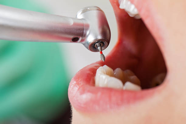 Best Emergency Dental Services for Seniors in Wheeler Af, HI